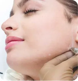 Tratamiento Ácido Hialurónico en Reborde Mandibular (Marcación)
