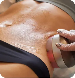 Tratamiento corporal con radiofrecuencia en el abdomen