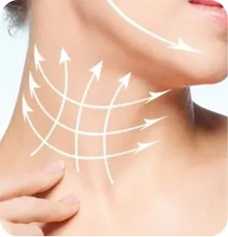 Tratamiento Flacidez en Cuello – Bioestimuladores de Colágeno