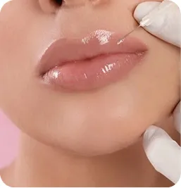 Tratamiento Ácido Hialurónico de Volumen en Labios