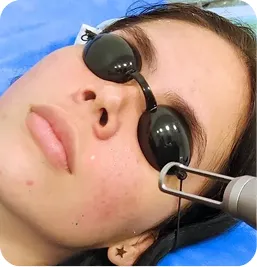 Tratamiento Láser Colormax Premier®