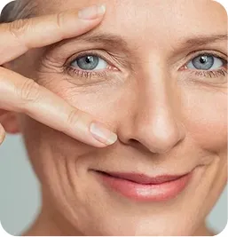 Tratamiento Radiesse® – Estimulación de Colágeno